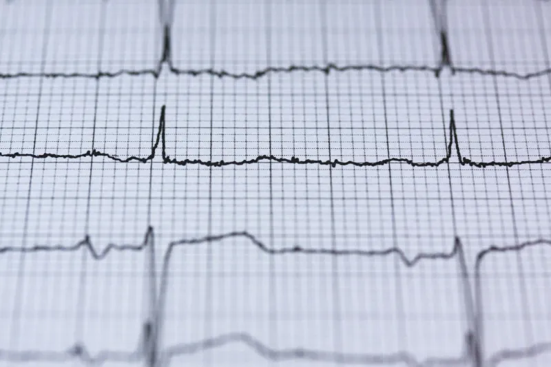 Before the EKG Changes: A Practical Risk-Stratification Framework for Azithromycin-Induced QT Prolongation in Polypharmacy Patients